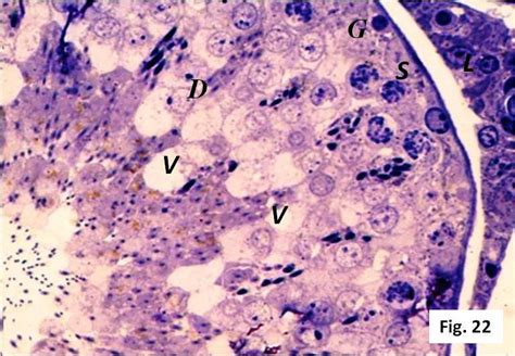 A Semithin Section Of The Testis Of A Mobile Adult Group Iib Albino