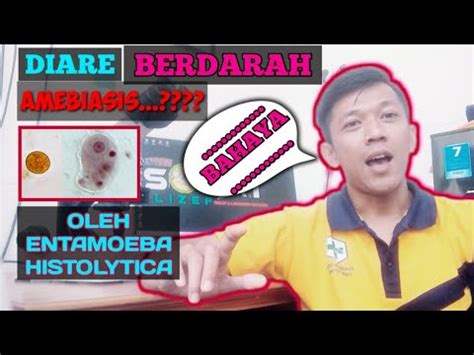 DIARE BERDARAH AMEBIASIS DISENTRI AMOEBA BAHAYA YouTube