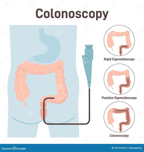 Colonoscopia Diagnostica Medica Dell Intestino Crasso