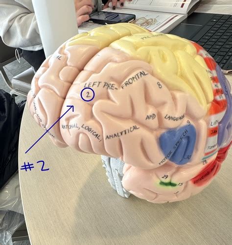 Neuro Lab Exam Flashcards Quizlet