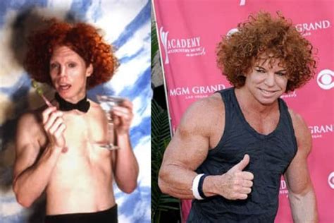 Did Carrot Top Get Plastic Surgery He Denies The Rumors