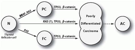 Poorly Differentiated Carcinoma | Basicmedical Key