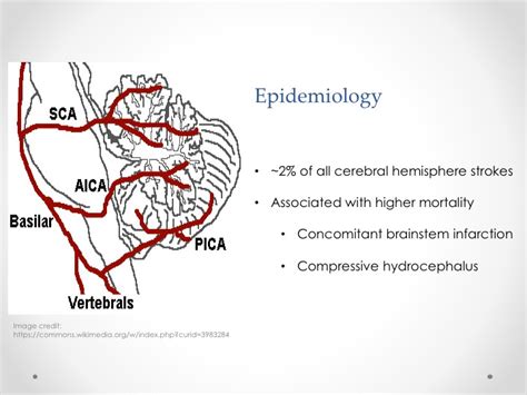 Cerebellar Stroke — learnED