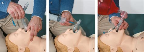 Fig 27 19 2 Etapas de colocación de una mascarilla laríngea Empendium