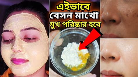 বেসনের সাথে এই জিনিসটা মিশিয়ে লাগাও মুখ পরিষ্কার থাকবেমুখের কালো দাগ