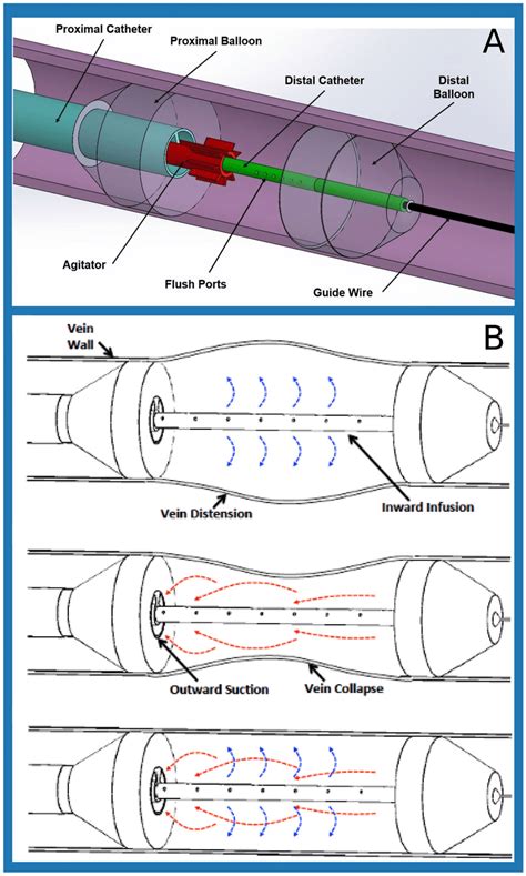 A Components Of The Multi Modal Sequestering Thrombectomy Catheter