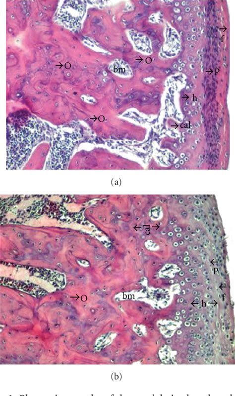 Figure 3 From Histologic Effects Of Bilateral Adrenalectomy Under The