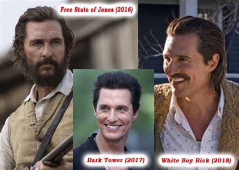 Matthew McConaughey Hair Loss Secrets Revealed!