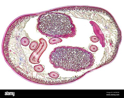 Ascaris Roundworm Light Micrograph Of A Transverse Section Through A Female Roundworm Ascaris