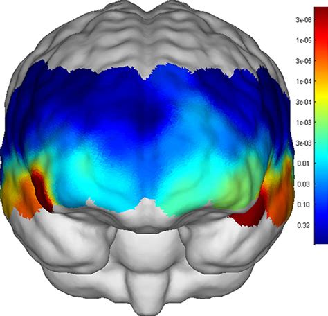 Frontiers Atypical Frontotemporal Cortical Activity In First Episode