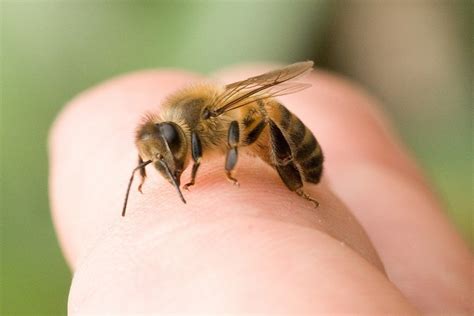 21 DIY Home Remedies For Treat Bee Sting