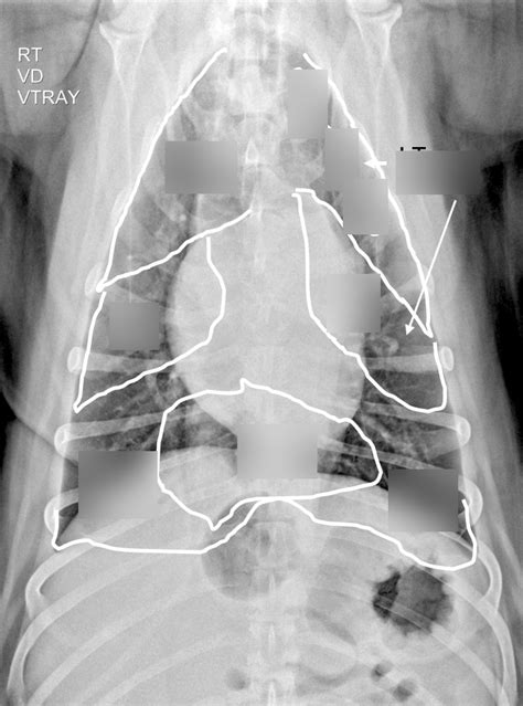 Lung Labeling Rad Diagram Quizlet