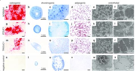 Multipotent Adipose Derived Stem Cell Adsc Differentiation Into Four