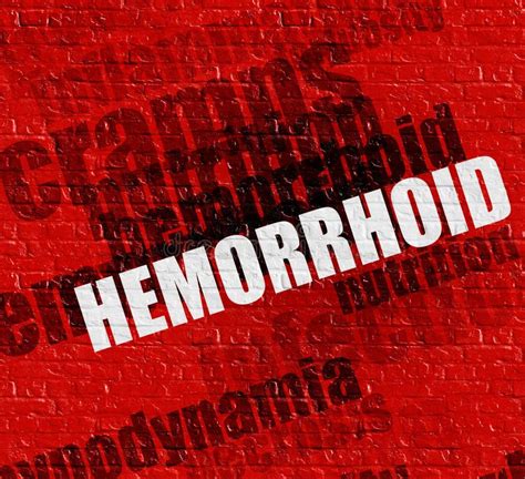 Hemorrhoidal Veins Stock Illustrations 8 Hemorrhoidal Veins Stock