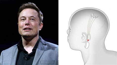 Musk Quiere Ponernos Chips En El Cerebro Y Dice Que Con Neuralink Podrá Hacerlo En 6 Meses