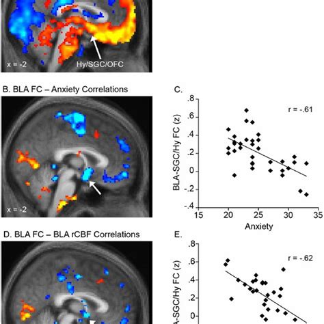 Bla Perfusion Mediates The Relationship Between Bla Mpfc Connectivity