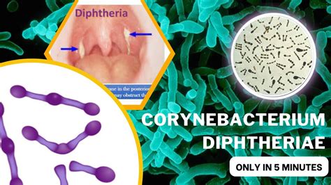 Corynebacterium Microbiology Lecture Corynebacterium Diphtheriae