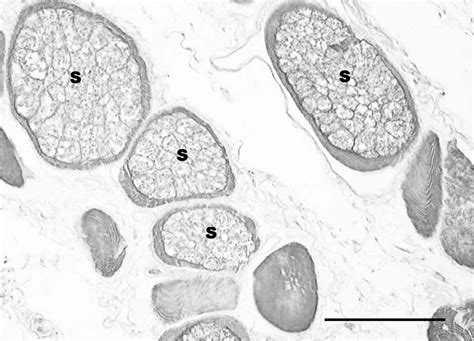 Hematoxylin And Eosin Stained Section Of Skeletal Muscle From Crotalus