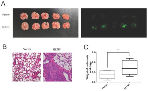 Eltd1 Promoted Crc Cell Metastasis In Vivo A Representative Gross