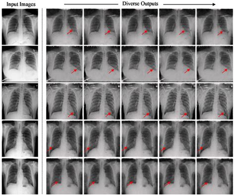 Bioengineering Free Full Text Diverse Covid Ct Image To Image