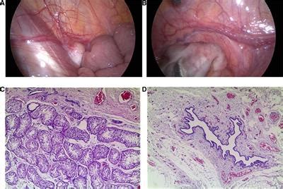 Frontiers Case Report De Novo Variant In Myelin Regulatory Factor In