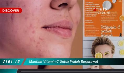 Manfaat Vitamin C Untuk Wajah Berjerawat Yang Perlu Anda Ketahui