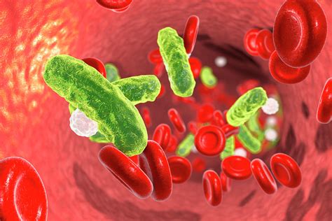 Bacterial Blood Infection Photograph By Kateryna Konscience Photo