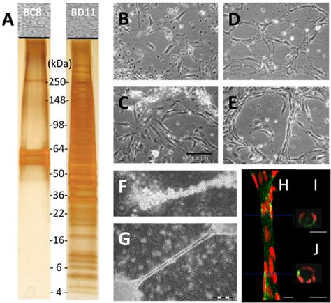 Analysis Of Hmsc Tert Bc And Bd Extracellular Matrix Ecm Sodium