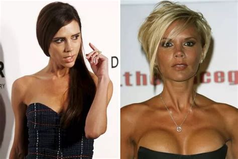 Breast Implants Nose Jobs And Filler Dramatic Celebrity