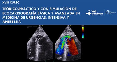 Xviii Curso Te Rico Pr Ctico Y Con Simulaci N De Ecocardiograf A B Sica