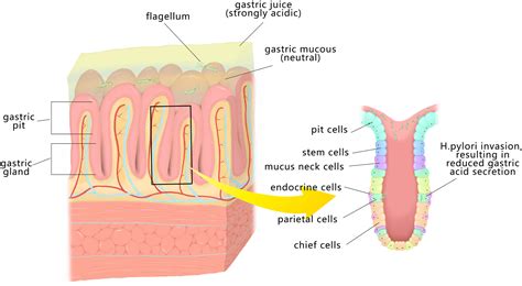 Frontiers Helicobacter Pylori And Autoimmune Diseases Involving