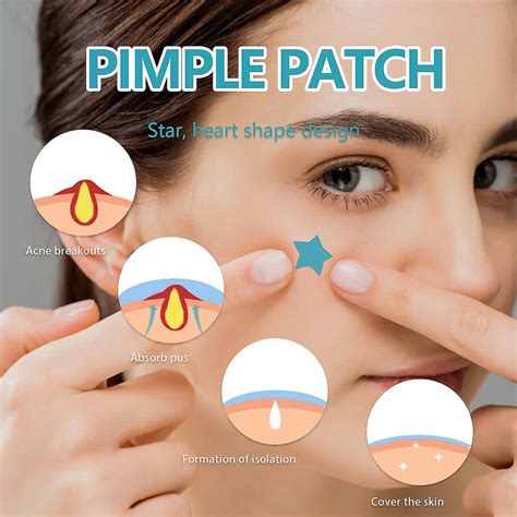 216pcs Pimple Patches, Invisible Natural Hydrocolloid Skin Tag Cover