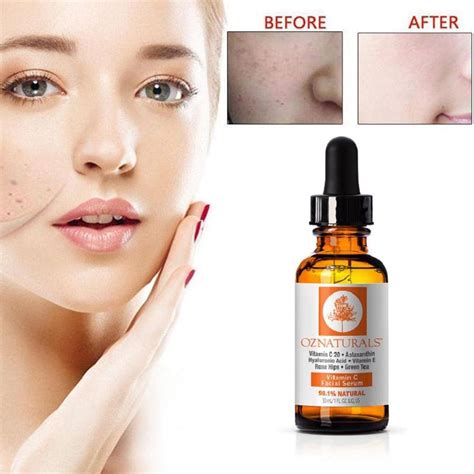 Face Serum Before And After Ubicaciondepersonas Cdmx Gob Mx