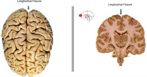 Neuroanatomy Exam Units Flashcards Quizlet