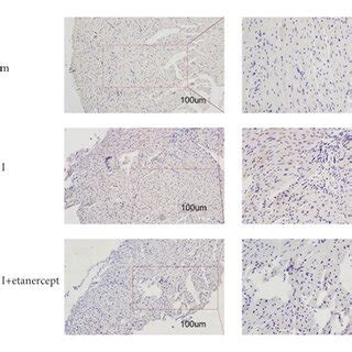 Expression Levels Of Dectin And Tnf Were Increased In Heart Tissue