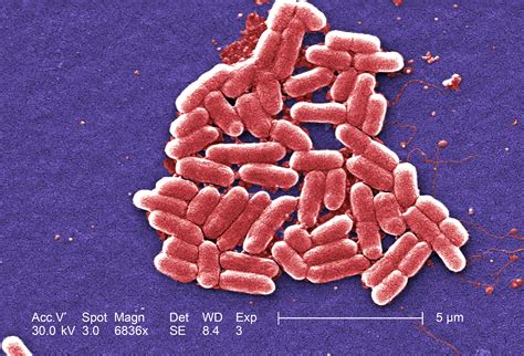 Free picture: gram, negative, Escherichia, Coli, bacteria