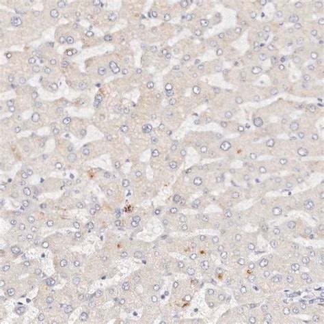 Anti Dnase Antibody Produced In Rabbit