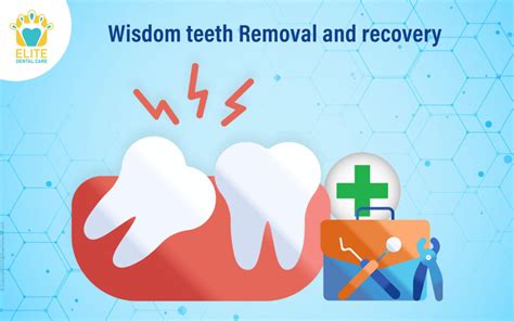 timeline of wisdom teeth removal recovery | Elite Dental Care