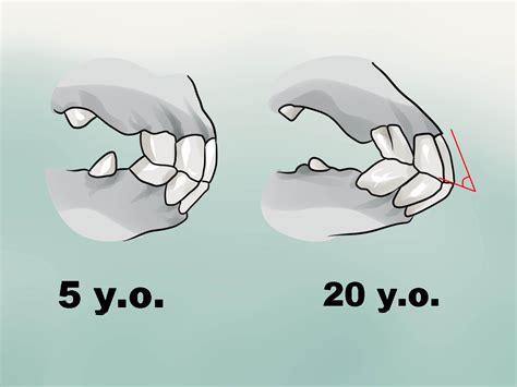 How to Tell a Horse's Age by Its Teeth (with Pictures) - wikiHow