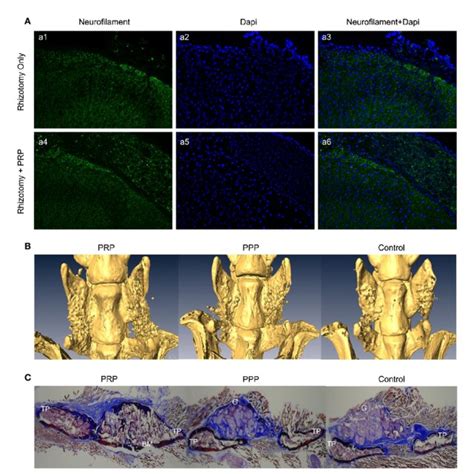 A Immunofluorescence Analysis Of Neurofilament In The Spinal Cord