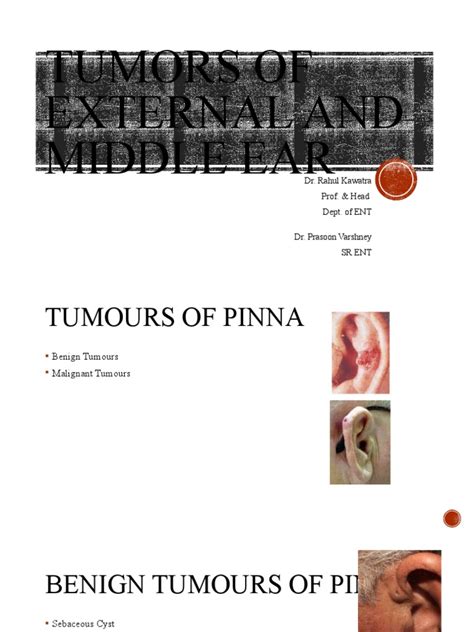 Tumors Of External And Middle Ear Pdf Ear Metastasis