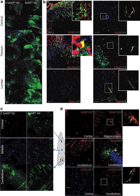 Green Fluorescent Protein GFP Expression Across The Mouse Nervous