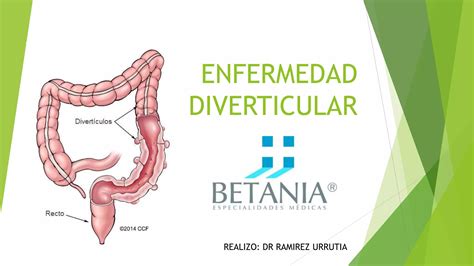 Enfermedad Diverticular Ppt