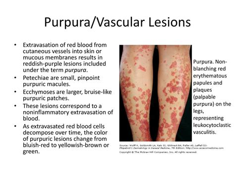 Ppt Dermatological History And Examination Powerpoint Presentation Free Download Id2324976