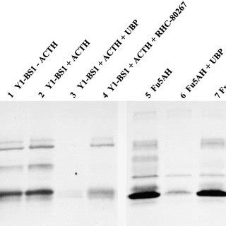 Uptake And Hydrolysis Of Hdl Cholesteryl Ester Ce By Scavenger