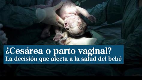 Nacer Por Cesárea O Parto Vaginal Condiciona La Salud De Tu Bebé