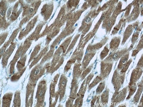 N Cadherin Antibody 22018 1 AP Proteintech