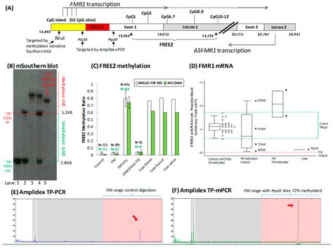 Fragile X Syndrome Southern Blot Analysis