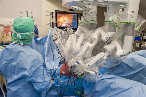 Irish Medics Perform First Ever Robot Assisted Liver And Lung Operation