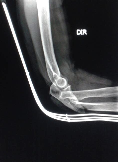 DICAS DE RADIOLOGIA Tudo Sobre Radiologia IMAGENS RADIOLÓGICAS